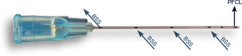 dualbore-sideflo-cannula-3425diagram